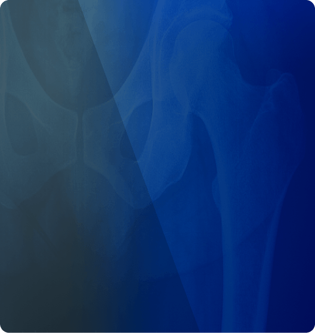 Laser Focused on Orthopedic Cutting Tools & Instruments